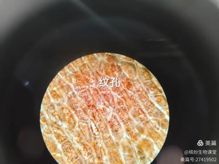 辣椒果皮红彤彤的有色体令人热血沸腾望眼欲穿找到了细胞的结构,必须